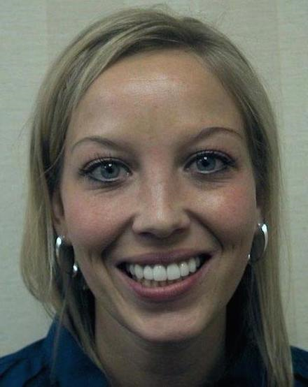 A woman smiling to show her dental work after treatment with our Wayzata dentist.